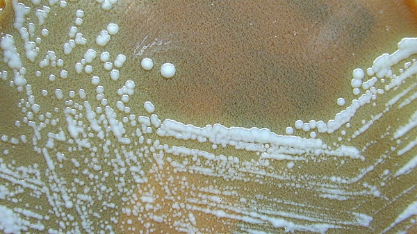 Туляремия: симптомы, переносчики, профилактика и лечение болезни Туляремия: симптомы, переносчики, профилактика и лечение болезни